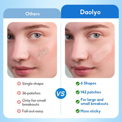 Large Acne Pimple Patches | 6 Sizes, 142 Counts, Hydrocolloid | Origin Zero